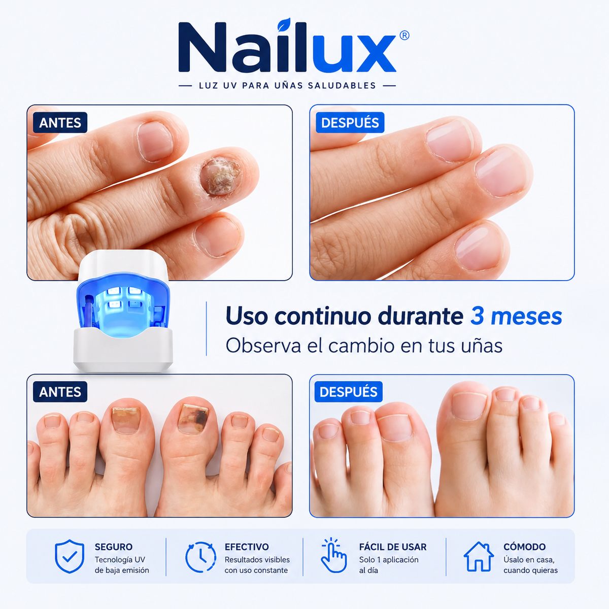 Nailux™ | Luz LED para uñas amarillas y deterioradas — 7 minutos al día desde casa, sin dolor y sin gastar cientos en sesiones. (Pruébalo 30 días) + HOY Aceite Reparador de Jengibre GRATIS
