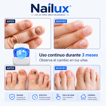 Nailux™ | Luz LED para uñas amarillas y deterioradas — 7 minutos al día desde casa, sin dolor y sin gastar cientos en sesiones. (Pruébalo 30 días) + HOY Aceite Reparador de Jengibre GRATIS