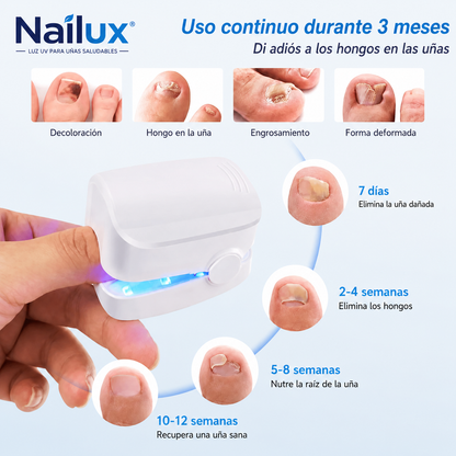 Nailux™ | Luz LED para uñas amarillas y deterioradas — 7 minutos al día desde casa, sin dolor y sin gastar cientos en sesiones. (Pruébalo 30 días) + HOY Aceite Reparador de Jengibre GRATIS