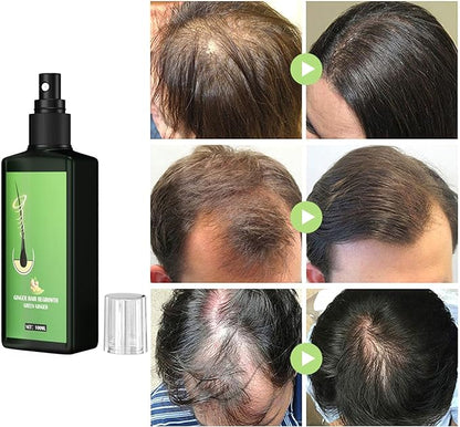 Elixir Capilar: Crecimiento y Control de Caída – 100% Natural - OFERTA 2X1