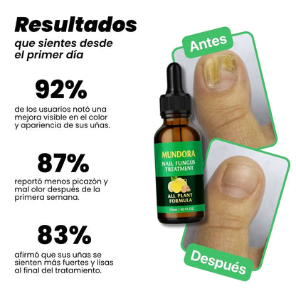 Fungiclear 7™ - TRATAMIENTO ANTI HONGOS 7 DÍAS 100% NATURAL
