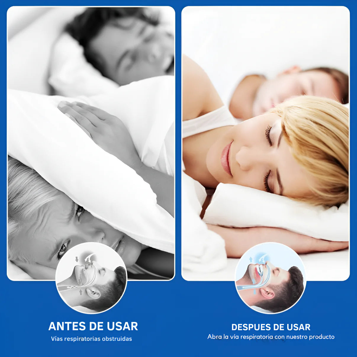 Protector Antirronquido Sueño Pleno OFERTA 2×1
